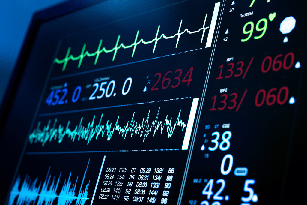 ECG Facility